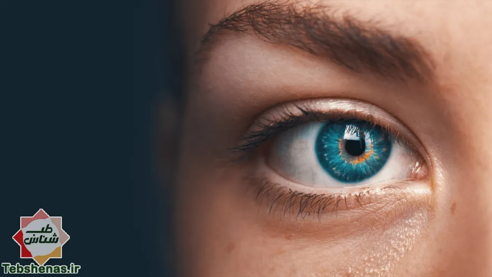 علل خشکی چشم و راه های درمان آن با طب سنتی