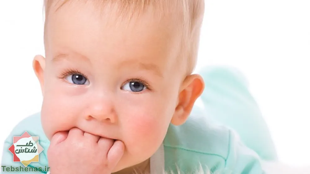 پیشگیری از برفک دهان نوزاد