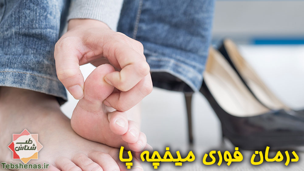 درمان فوری میخچه پا|درمان میخچه افراد دیابتی