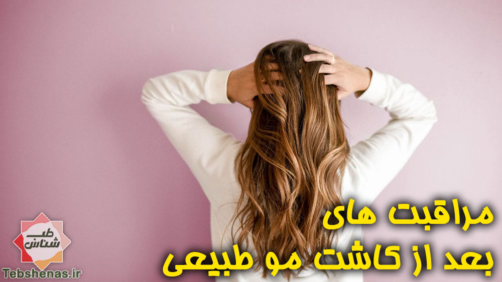 مراقبت های بعد از کاشت مو طبیعی|مراقبت های بعد از کاشت مو دائمی|مراقبت های بعد از کاشت مو