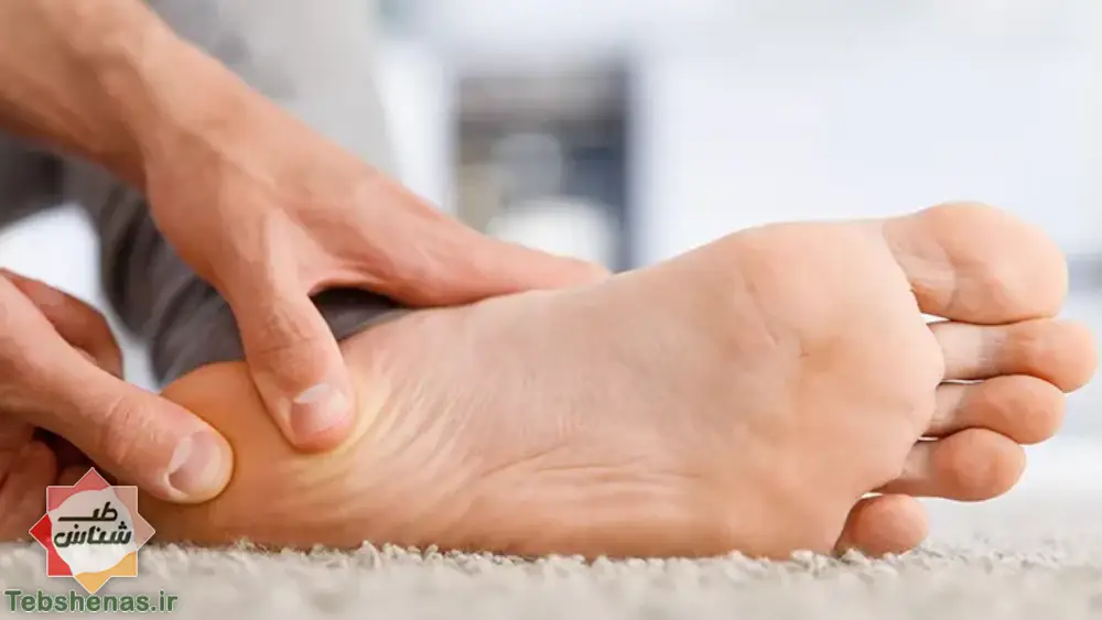 درمان خار پاشنه در طب سنتی + 5 راهکار برای درمان خار پاشنه|درمان خار پاشنه|درمان خار پاشنه