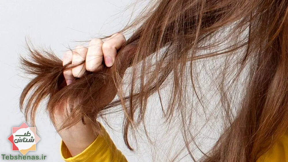 روغنی شگفت انگیز برای پرپشتی مو و رفع کچلی|تقویت موها و پرپشت کردن مو