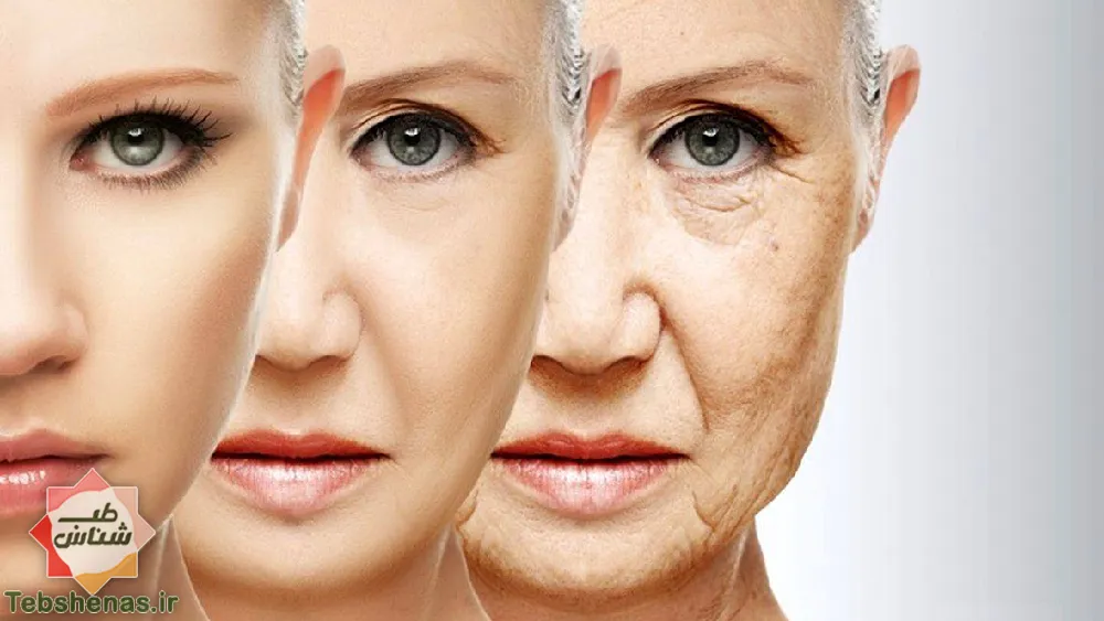 جلوگیری از پیری زودرس با طب سنتی ایرانی و اسلامی|درمان پیری زودرس|پیری زودرس