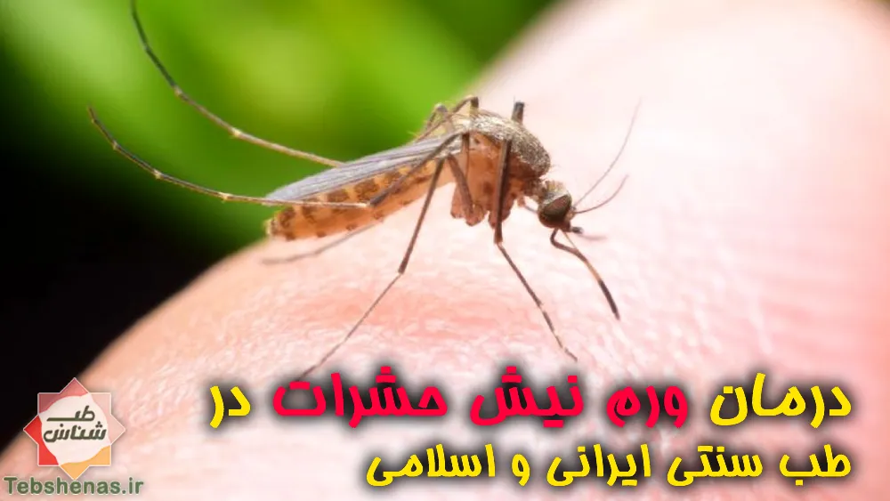 درمان ورم نیش پشه و حشرات