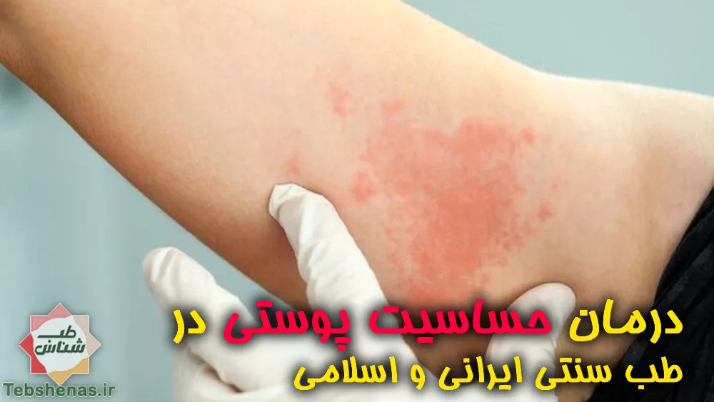 درمان حساسیت پوستی
