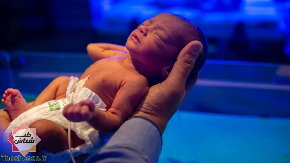 نکات مهم اولین واکسن نوزاد