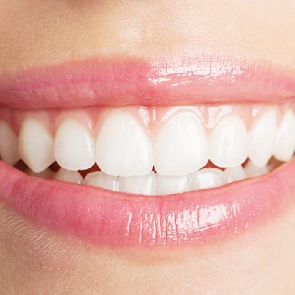 جلوگیری-از-بیماری-های-لثه-و-دهان-و-پوسیدگی-دندان